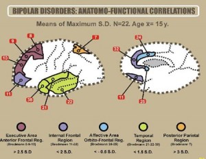 bipolarbrain